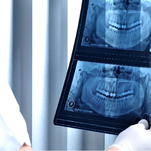 P175 Radiography for Dentists (Operator) and Dental Radiographers (Course 2): IRMER, Safe Working Practices in the Dental Clinic thumbnail